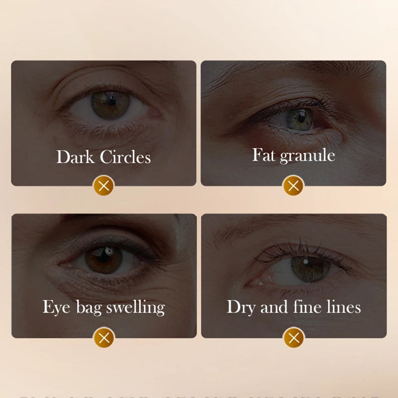 Lurxe | Snake Venom Anti-Wrinkle Eye Cream