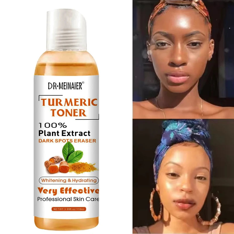 Lurxe | Turmeric Brightening Face Serum